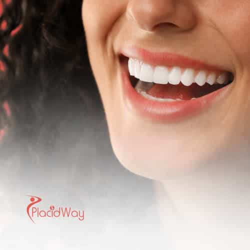 Cosmetic Dentistry in Colombia: Best Veneers and Smile Makeovers for Puerto Rican Patients